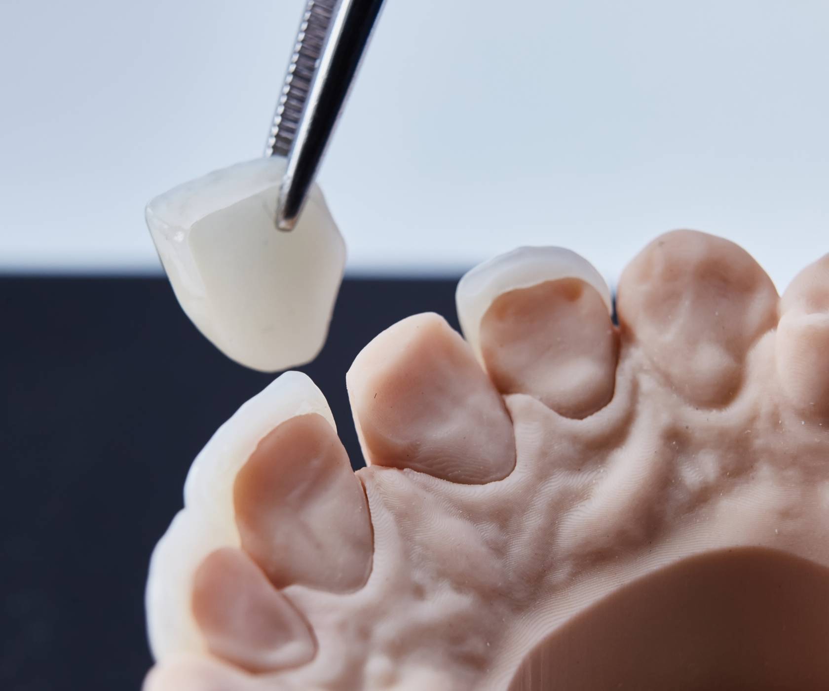 Escaner intraoral en clinica dental proboca cantabria