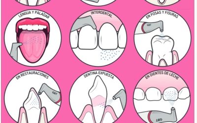 Terapia de Higiene sin Dolor GBT® en Santoña